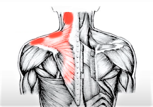 Означает ли боль в мышцах эффективную тренировку?