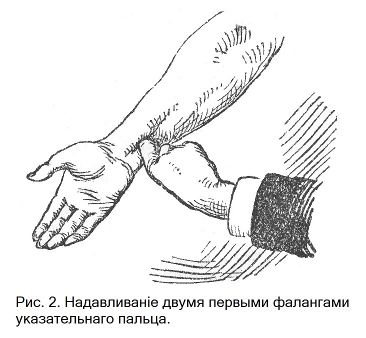 Надавливаніе двумя первыми фалангами указательнаго пальца.